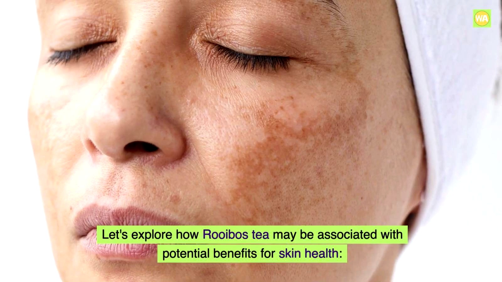 3. Skin Health discussed in the video