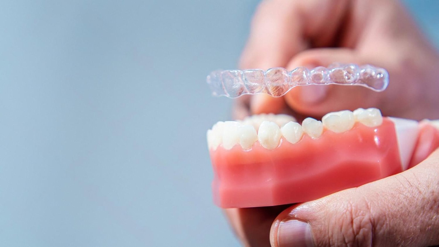 Clear Invisalign aligner being placed on a lower dental model